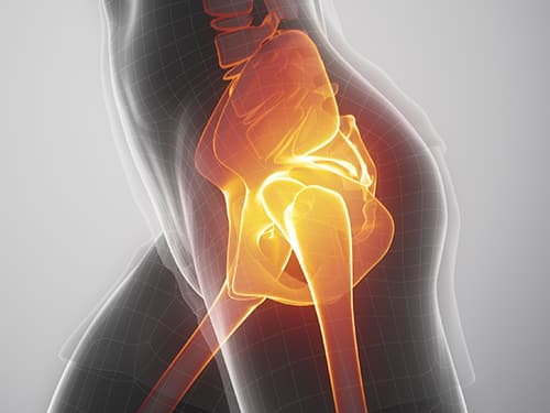 Medical illustration of the human hip joint highlighting the pelvis, femur, and surrounding skeletal structures, used to demonstrate hip anatomy, joint function, mobility, and musculoskeletal health.